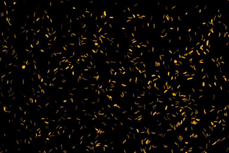 Microscope image of vibrio bacteria (aka vibrions). Photo: Angela Marulanda, GEOMAR Microscope image of vibrio bacteria (aka vibrions). Photo: Angela Marulanda, GEOMAR