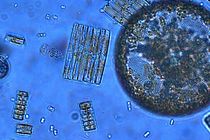 Phytoplankton from the Southern Ocean. Photo: Jeff McQuaid.